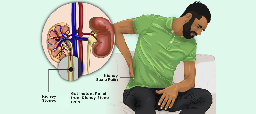 Natural herbs for Renal or Kidney Stones