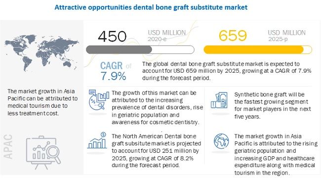 Dental Bone Graft Substitute Market Worth $659 million by 2025