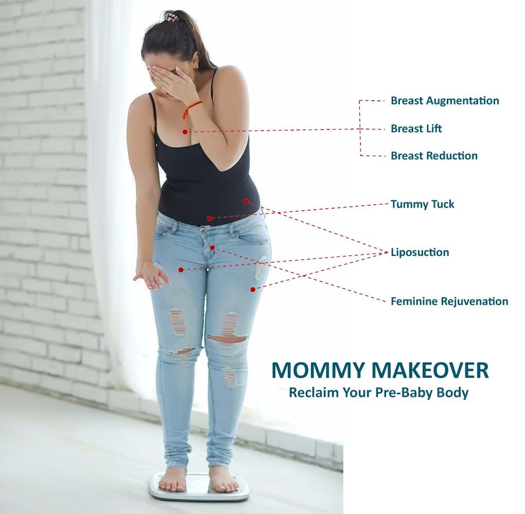 Mommy makeover: Recover your figure after pregnancy