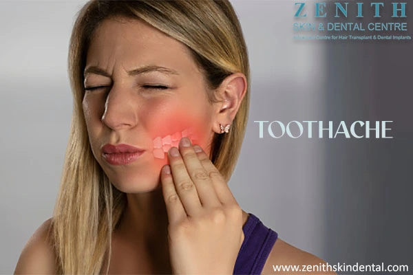 Causes and Symptoms of Toothache
