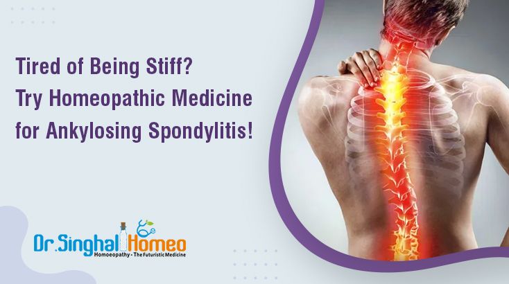 Tired of Being Stiff? Try Homeopathic Medicine for Ankylosing Spondylitis!