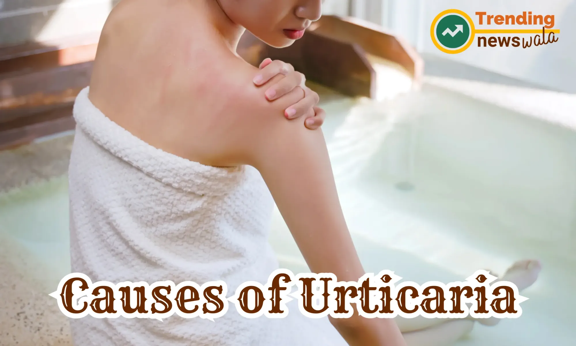 Urticaria: Symptoms, Causes, and Treatment