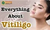 Vitiligo Homeopathy Cure