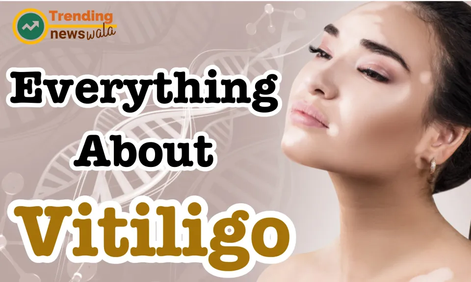 Vitiligo Homeopathy Cure